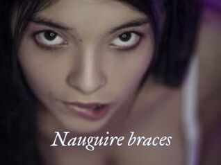 Nauguire_braces